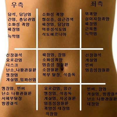 복통의 부위별 특징