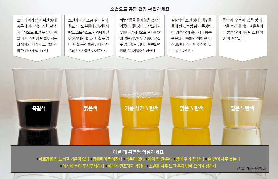 소변 색깔에 따른 콩팥(신장)의 건강 상태 | 포항 속시원 내과